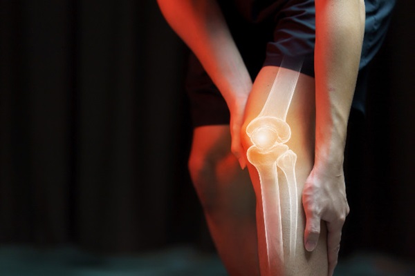 Afinal, correr contribui para o desgaste do joelho ou para proteger as articulações?
